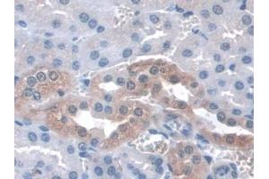 Detection of ITGa3 in Mouse Kidney Tissue using Polyclonal Antibody to Integrin Alpha 3 (ITGa3)