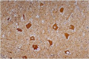 Immunohistochemistry staining of human cerebellum (paraffin-embedded sections) with anti-neurofilament heavy protein (NF-01). (NEFH anticorps)