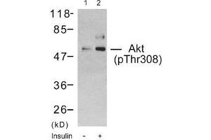 Western blot analysis using Akt (phospho-Thr308) antibody (E011055): Lane1: The extract from 293 cells untreated, Lane 2: The extract from 293 cells treated with insulin. (AKT1 anticorps  (pThr308))