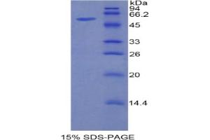 SDS-PAGE analysis of Mouse HGFAC Protein. (HGFA Protéine)