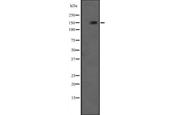 NRIP1 anticorps  (C-Term)