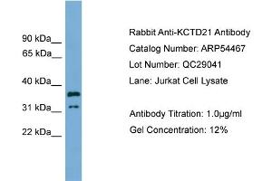 WB Suggested Anti-KCTD21  Antibody Titration: 0. (KCTD21 anticorps  (Middle Region))