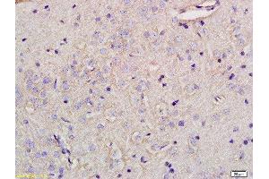 Formalin-fixed and paraffin embedded rat brain tissue labeled with Anti-Glypican 5 Polyclonal Antibody, Unconjugated at 1:200 followed by conjugation to the secondary antibody (GPC5 anticorps  (AA 251-350))