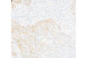 Immunohistochemistry (IHC) image for anti-HRas proto-oncogene, GTPase (HRAS) (AA 50-100) antibody (ABIN7795745)