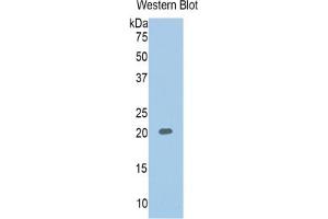 WB of Protein Standard: different control antibodies against Highly purified E. (SERPINA6 Kit ELISA)