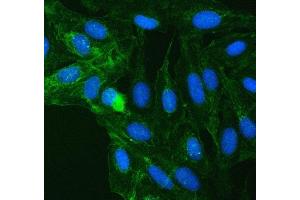 IF analysis of SUCLG2 using anti-SUCLG2 antibody (ABIN7601694). (SUCLG2 anticorps  (AA 42-424))