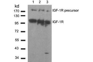 Image no. 2 for anti-Insulin-Like Growth Factor 1 Receptor (IGF1R) (Tyr1280) antibody (ABIN197576) (IGF1R anticorps  (Tyr1280))