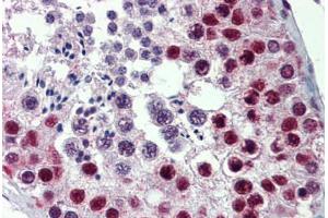 Human Testis: Formalin-Fixed, Paraffin-Embedded (FFPE)