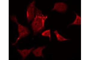 ABIN6266459 staining Hela by IF/ICC. (FER anticorps  (pTyr402))