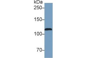 Detection of NOS2 in Human Serum using Monoclonal Antibody to Nitric Oxide Synthase 2, Inducible (NOS2) (NOS2 anticorps  (AA 734-966))