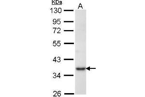 WB Image Sample (30 ug of whole cell lysate) A: Molt-4 , 10% SDS PAGE antibody diluted at 1:1000 (PRPS1 anticorps)