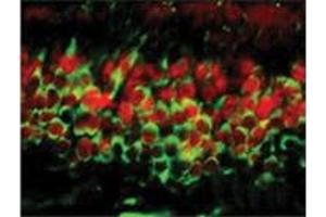 Dnmt3a Immunofluorescence.