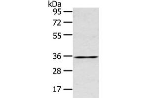Gel: 10 % SDS-PAGE, Lysate: 40 μg, Lane: Human placenta tissue, Primary antibody: ABIN7190810(GJB5 Antibody) at dilution 1/400 dilution, Secondary antibody: Goat anti rabbit IgG at 1/8000 dilution, Exposure time: 15 seconds (GJB5 anticorps)