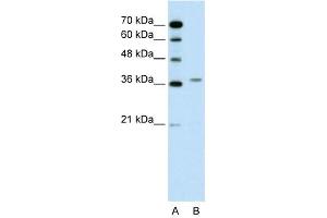 WB Suggested Anti-ALAD  Antibody Titration: 0. (ALAD anticorps  (N-Term))