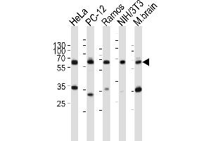 Western blot analysis of lysates from HeLa, rat PC-12, Ramos, mouse NIH/3T3 cell line, mouse brain tissue lysate(from left to right), using PKM2-N491 at 1:1000 at each lane.