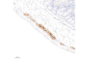 Immunohistochemistry analysis of paraffin embedded rat colon using peripherin (ABIN7075012) at dilution of 1: 1600