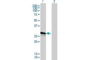 Western Blot analysis of GJB3 expression in transfected 293T cell line by GJB3 monoclonal antibody (M01), clone 3B4-1B3.