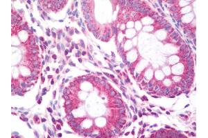 Anti-CAD antibody IHC staining of human colon.