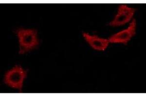 ABIN6267483 staining MCF-7 cells by ICC/IF.