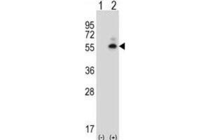 Western Blotting (WB) image for anti-Calcium/calmodulin-Dependent Protein Kinase II delta (CAMK2D) antibody (ABIN5017149) (CAMK2D anticorps)