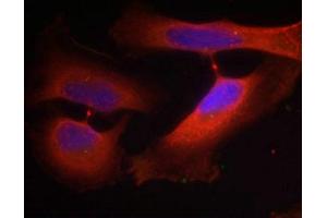 Immunofluorescence staining of methanol-fixed Hela cells using Keratin 8(Phospho-Ser74) Antibody. (KRT8 anticorps  (pSer74))