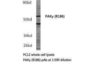Western blot (WB) analysis of PAKγ antibody in extracts from PC12 cells. (PAK2 anticorps)
