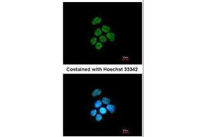 ICC/IF Image Immunofluorescence analysis of paraformaldehyde-fixed A431, using hnRNP K, antibody at 1:200 dilution. (HNRNPK anticorps)