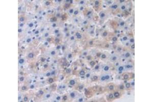 IHC-P analysis of Rat Tissue, with DAB staining. (SCGB1A1 anticorps  (AA 22-96))