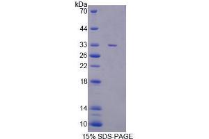 Image no. 1 for Cancer Susceptibility Candidate 5 (CASC5) (AA 1-230) protein (His tag) (ABIN6239692)