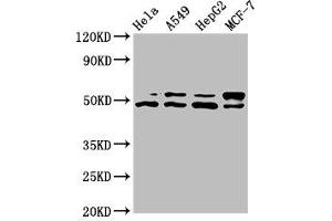 Western Blot Positive WB detected in: Hela whole cell lysate, A549 whole cell lysate, HepG2 whole cell lysate, MCF-7 whole cell lysate All lanes: AKT1 antibody at 7. (AKT1 anticorps  (AA 1-480))