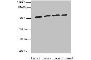 Western blot All lanes: ETNK1 antibody at 0. (Ethanolamine Kinase 1 anticorps  (AA 90-258))