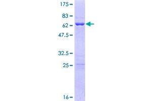 Image no. 1 for POU Class 6 Homeobox 1 (POU6F1) (AA 1-301) protein (GST tag) (ABIN1315806)