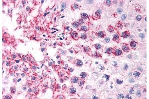 Human Testis (formalin-fixed, paraffin-embedded) stained with TFF2 antibody ABIN351426 at 15 ug/ml followed by biotinylated goat anti-rabbit IgG secondary antibody ABIN481713, alkaline phosphatase-streptavidin and chromogen. (Trefoil Factor 2 anticorps  (Internal Region))