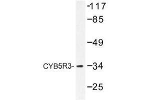 Image no. 2 for anti-Cytochrome B5 Reductase 3 (CYB5R3) antibody (ABIN317921) (CYB5R3 anticorps)