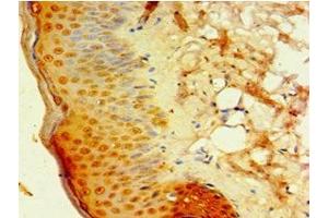 Immunohistochemistry of paraffin-embedded human skin tissue using ABIN7145488 at dilution of 1:100 (DEFB4A anticorps  (AA 1-64))