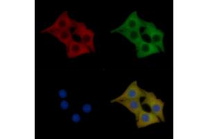 PKD1/PKC mu Mouse Monoclonal Antibody staining Hela cells by IF/ICC. (PKC mu anticorps)