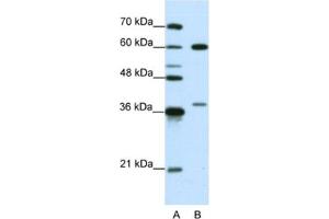 Western Blotting (WB) image for anti-Heterogeneous Nuclear Ribonucleoprotein L (HNRNPL) antibody (ABIN2462110) (HNRNPL anticorps)