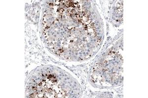 Immunohistochemical staining (Formalin-fixed paraffin-embedded sections) of human testis shows strong positivity in a subset of cells in seminiferous tubules. (CXORF61 anticorps)