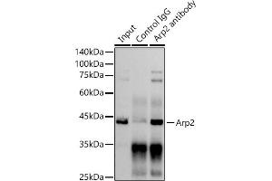 Immunoprecipitation analysis of 300 μg extracts of C6 cells using 3 μg Arp2 antibody (ABIN7265391). (ACTR2 anticorps)