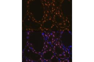 Immunofluorescence analysis of rat thyroid using TTF1 Rabbit mAb (ABIN1679475, ABIN3017648, ABIN3017649 and ABIN7101514) at dilution of 1:100 (40x lens).