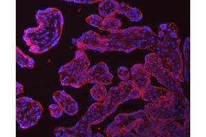 IF analysis of SRPRA using anti-SRPRA antibody (ABIN7601408). (SRPRA (AA 346-638) anticorps)