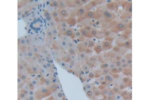 Used in DAB staining on fromalin fixed paraffin- embedded Kidney tissue