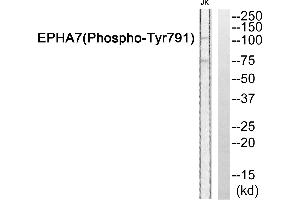 Western blot analysis of extracts from JurKat cells, using EPHA7 (Phospho-Tyr791) antibody. (EPH Receptor A7 anticorps  (pTyr791))