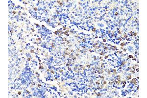 Immunohistochemistry of paraffin-embedded mouse spleen using S100A9 antibody. (S100A9 anticorps)