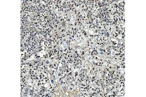 IHC analysis of TBX18 using anti-TBX18 antibody (ABIN7599494).