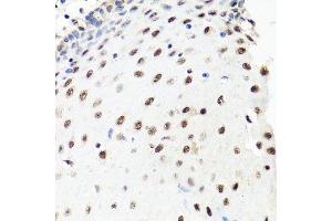 Immunohistochemistry of paraffin-embedded human esophagus using PRPF8 antibody.