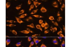 Immunofluorescence analysis of L929 cells using CEP55 Polyclonal Antibody at dilution of 1:100.