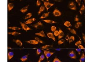 Immunofluorescence analysis of L929 cells using CEP55 Polyclonal Antibody at dilution of 1:100. (CEP55 anticorps)