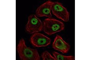 Immunofluorescence analysis of NIH/3T3 cells using SMC1 mouse mAb (green). (SMC1A anticorps)