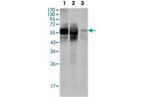 Western blot analysis using GPI monoclonal antobody, clone 1B7D7  against HepG2 (1) , SMMC-7721 (2) cell lysate and rat liver tissue lysate (3).